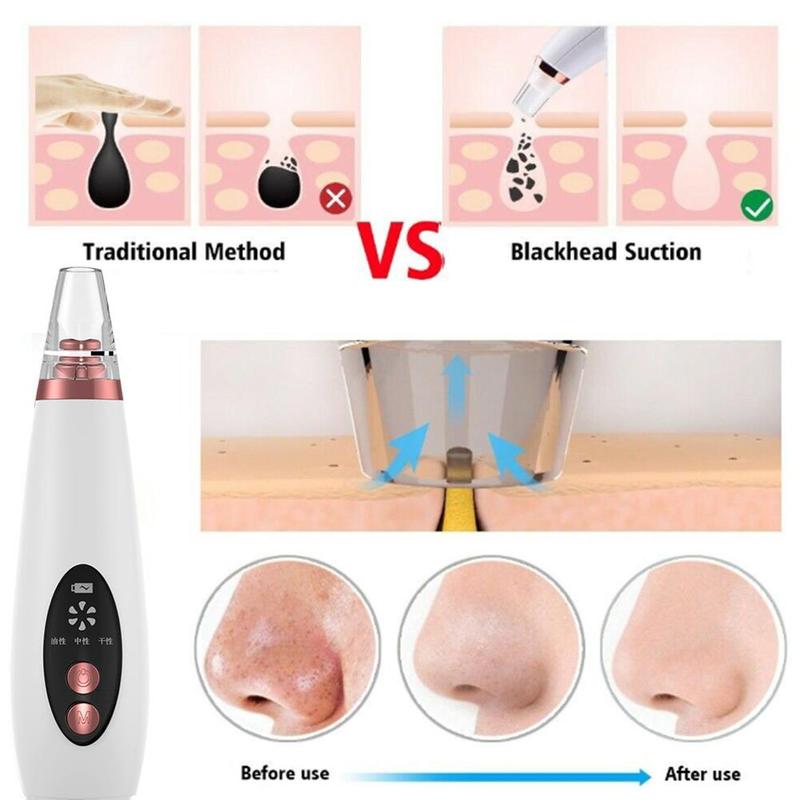 USB Vacuum Pore & Blackhead Cleaner